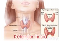 Kelenjar Tiroid