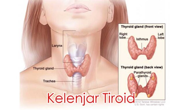 Kelenjar Tiroid
