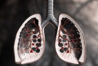 Alveolus