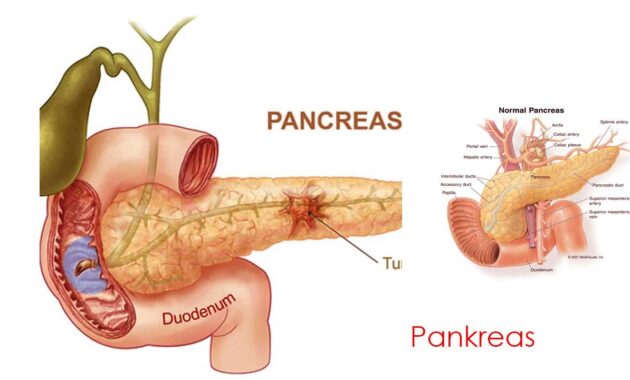 gambar Pankreas
